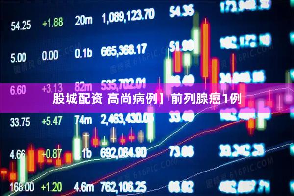 股城配资 高尚病例】前列腺癌1例